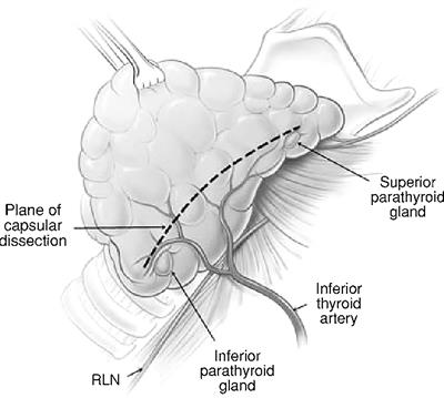 Preservation of parathyroid glands during thyroid and neck surgery